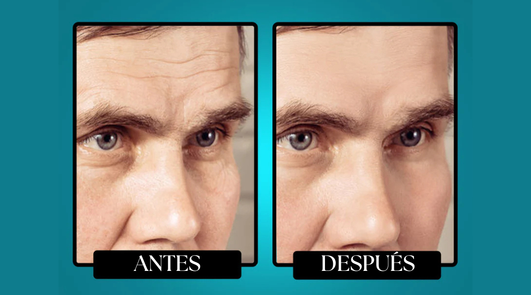 Morge™️ Bálsamo Antirarrugas