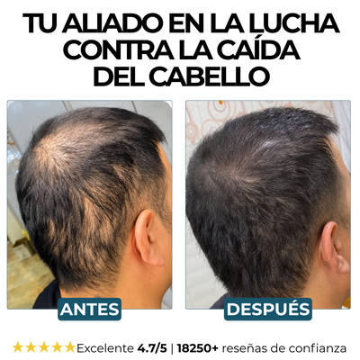 Champú Activador de Raíces Morge™