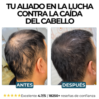 Champú Activador de Raíces Morge™