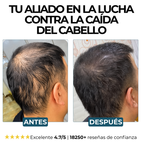 Champú Activador de Raíces Morge™
