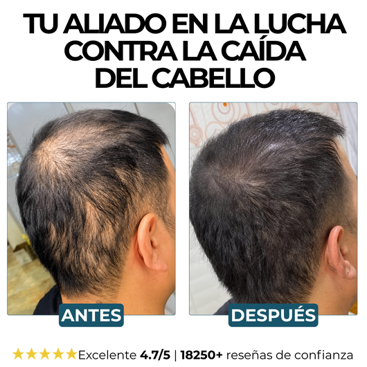 Champú Activador de Raíces Morge™