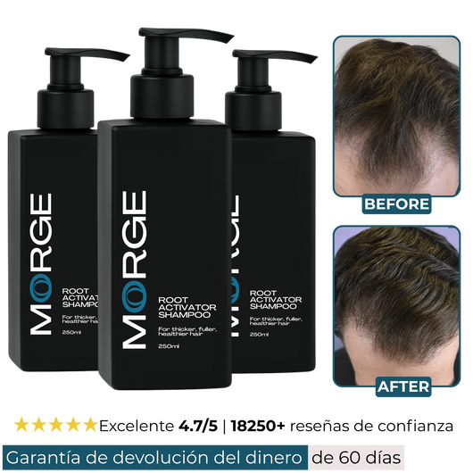 Champú Activador de Raíces Morge™