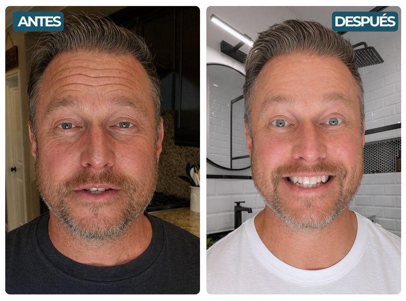 Fotografías antes y después de Rubén