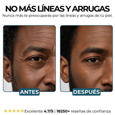 Morge™️ Bálsamo Antirarrugas BLACK