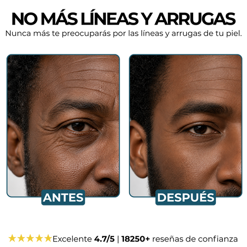 Morge™️ Bálsamo Antirarrugas BLACK