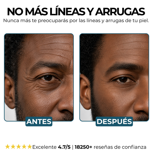 Morge™️ Bálsamo Antirarrugas BLACK