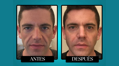 Morge™️ Bálsamo Antirarrugas