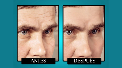 Morge™️ Bálsamo Antirarrugas